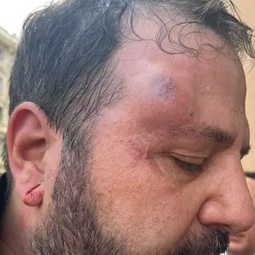 La solidarietà della Cgil a Luca Blasi, vittima di una carica delle forze dell’ordine al corteo “No dl Sicurezza”