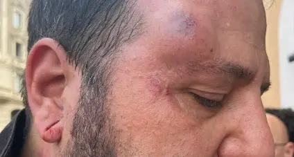 La solidarietà della Cgil a Luca Blasi, vittima di una carica delle forze dell’ordine al corteo “No dl Sicurezza”